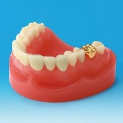 Zubn nhrady