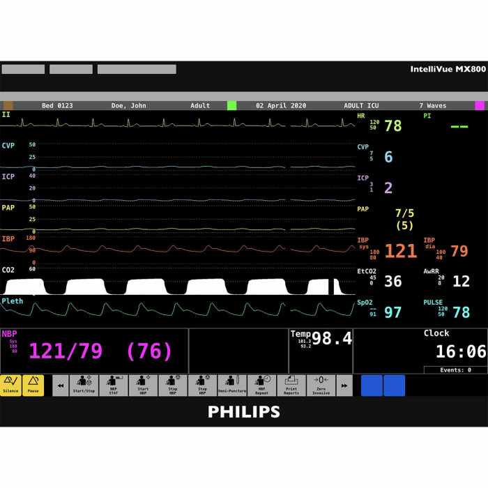 Simultor obrazovky pacientskho monitoru Philips IntelliVue MX800 pro REALITi360