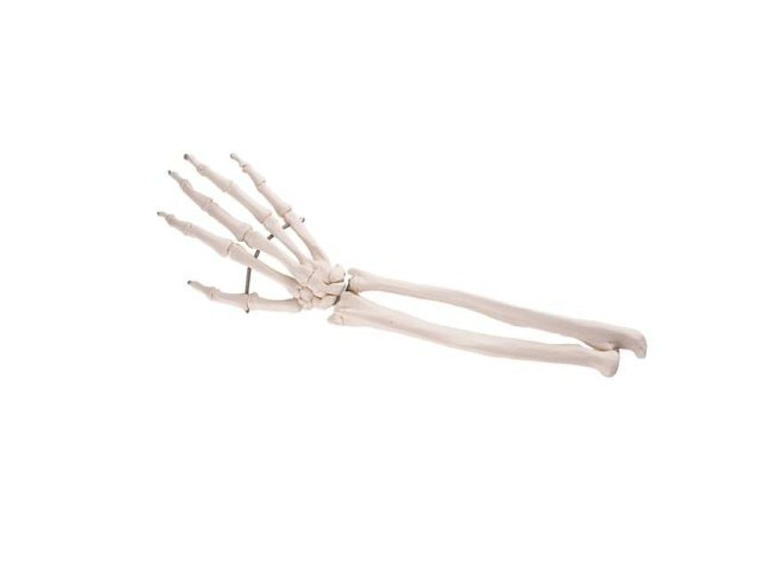 A41 - Kostra ruky s stmi ulnrn a radiln kosti