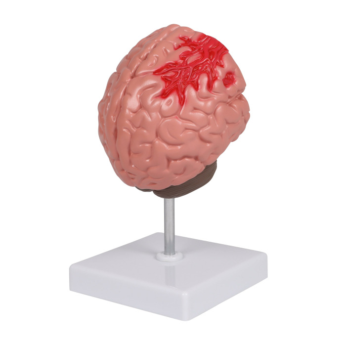 C711 - Patologie mozku