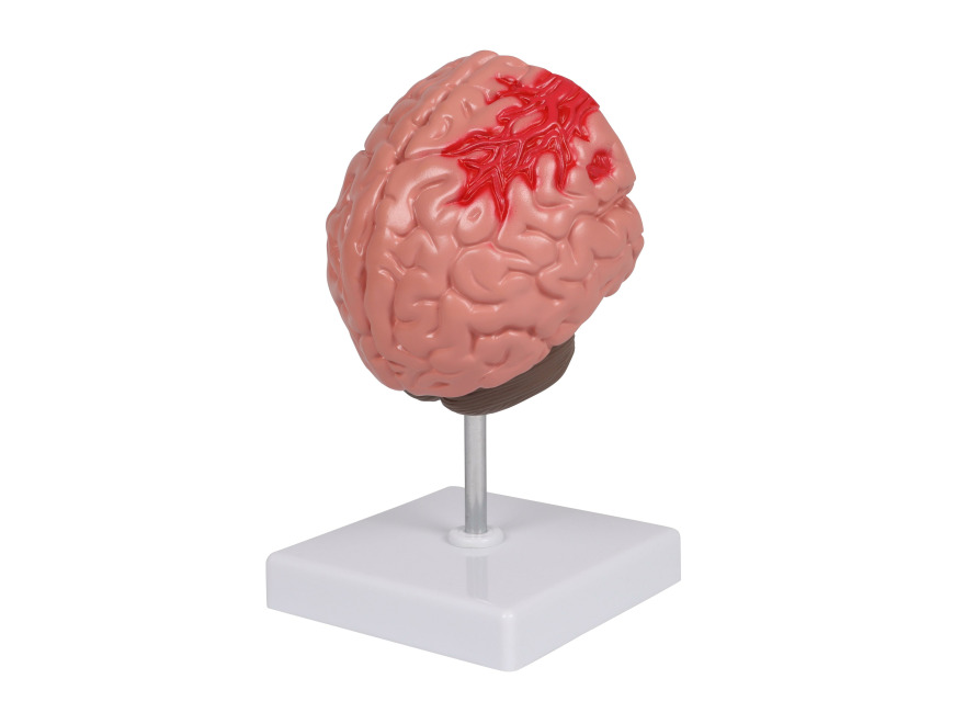 C711 - Patologie mozku