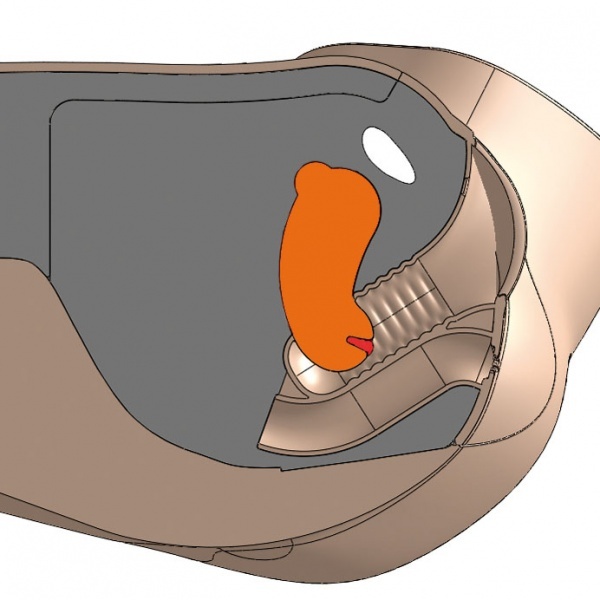 60922 - CFPT Modul 3: mal fibroid  s polypy dlonho hrdla
