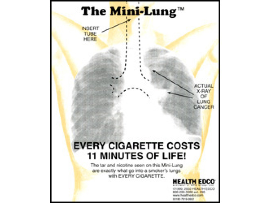 Flie Mini-Lung 100 ks