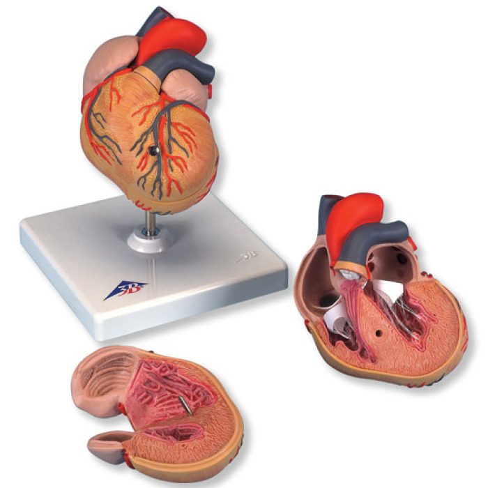 G04 - Klasick model srdce s hypertrofi lev komory, 2 sti