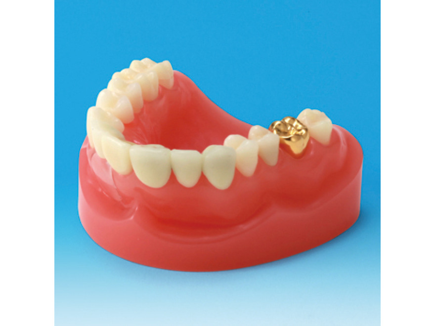 Model restaurace/nhrady zubu PE-PRO001