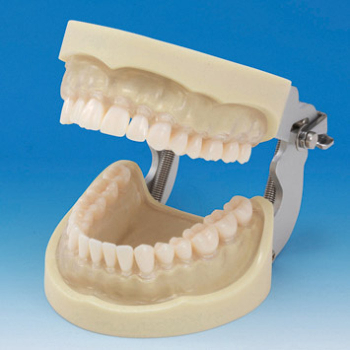 Model elisti s protetickou nhradou (32 zub) - transparentn dse