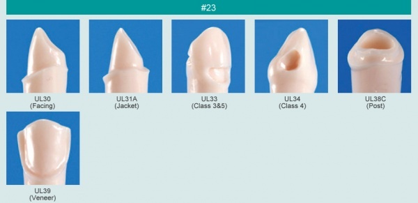 Model zubu s klnovm defektem (zub . 23)