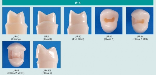 Model zubu s klnovm defektem (zub . 14)