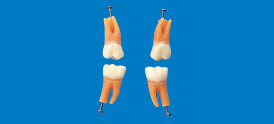Model zubu s rozvtvenm koenem (zub . 36)