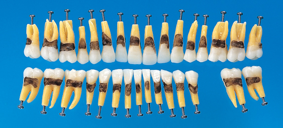 Anatomick model zubu s jednoduchm koenem (sada 31 zub)