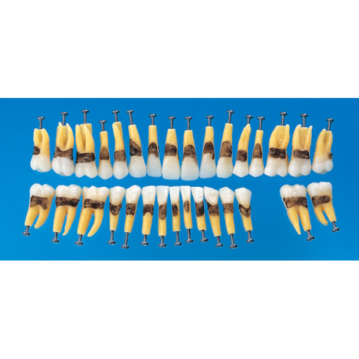 Anatomick model zubu s jednoduchm koenem (sada 31 zub)