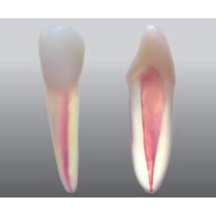 Endodontick model zubu - 1 kanlek