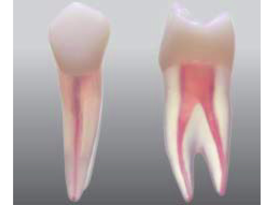 Endodontick model zubu - 2 kanlky