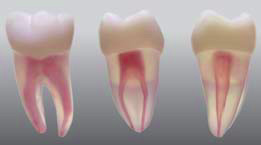 Endodontick model zubu - 2 kanlky