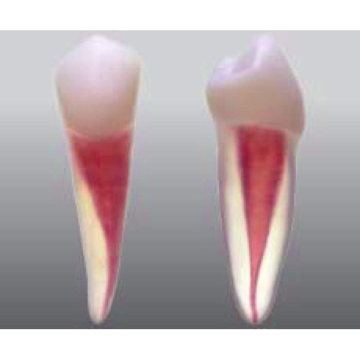 Endodontick model zubu - 1 kanlek