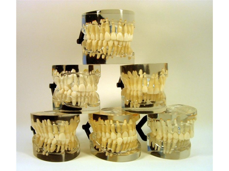 MDO-18 - Ortodontick modely