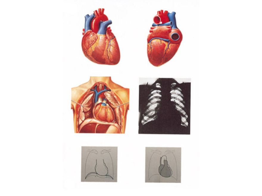 V2053U - Lidsk srdce