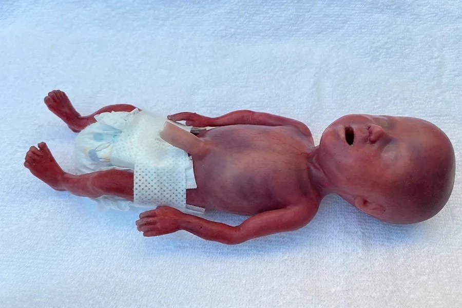 Pedasn narozen novorozenec (22-23 tdn) - Realistick figurna