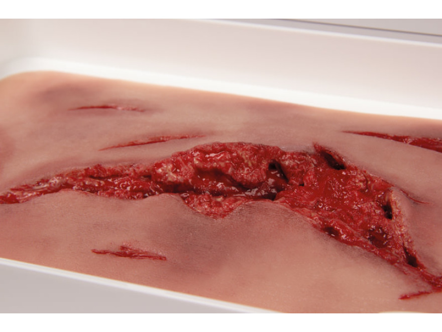 NW101 - Model velké tržné rány s funkcí krvácení