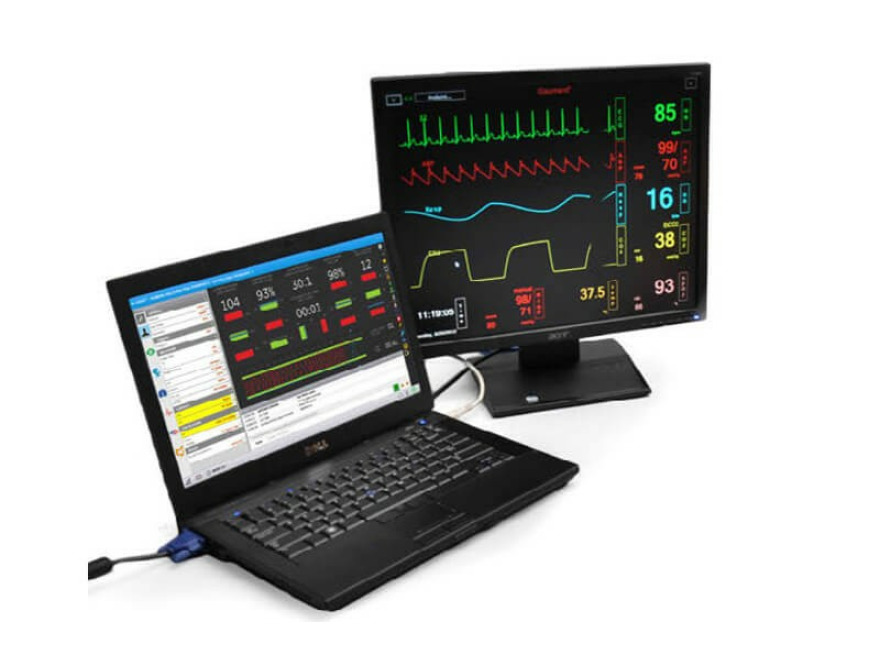 Virtuln pacientsk monitor pro Code Blue III - dospl